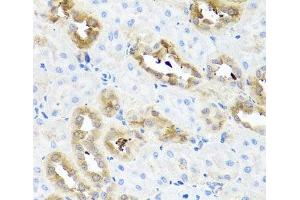 Immunohistochemistry of paraffin-embedded Rat kidney using FABP5 Polyclonal Antibody at dilution of 1:100 (40x lens). (FABP5 anticorps)