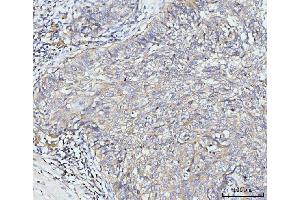 IHC analysis of Golgin 97/GOLGA1 using anti-Golgin 97/GOLGA1 antibody (ABIN7599539). (GOLGA1 anticorps  (AA 1-752))