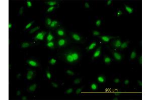 Immunofluorescence of monoclonal antibody to RNF12 on HeLa cell. (RLIM anticorps  (AA 1-83))