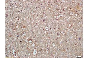 Formalin-fixed and paraffin embedded rat brain labeled with Rabbit Anti-IKK gamma (Ser376) Polyclonal Antibody, Unconjugated  at 1:200 followed by conjugation to the secondary antibody and DAB staining (IKBKG anticorps  (pSer376))