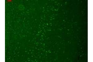 TRPM7 Immunofluorescence.