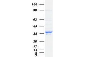 Validation with Western Blot