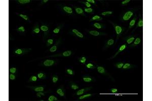 Immunofluorescence of purified MaxPab antibody to EWSR1 on HeLa cell. (EWSR1 anticorps  (AA 1-656))