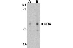 Western Blotting (WB) image for anti-CD4 (CD4) (N-Term) antibody (ABIN492543) (CD4 anticorps  (N-Term))
