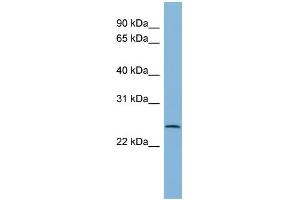 WB Suggested Anti-CXorf26 Antibody Titration: 0.