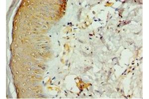 Immunohistochemistry of paraffin-embedded human skin tissue using ABIN7168977 at dilution of 1:100 (STK16 anticorps  (AA 1-305))