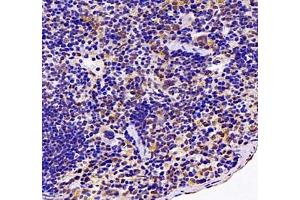 Immunohistochemistry of paraffin embedded mouse spleen using Neil1 (ABIN7073820) at dilution of 1: 1200 (400x lens)