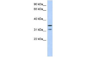 WB Suggested Anti-C17orf81 Antibody Titration: 0. (Retinoic Acid Induced 12 (RAI12) (Middle Region) anticorps)