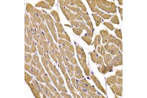 Immunohistochemistry of paraffin-embedded mouse heart using SLC2A4 antibody.