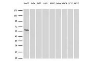 Western Blotting (WB) image for anti-Formiminotransferase Cyclodeaminase (FTCD) antibody (ABIN1496380)