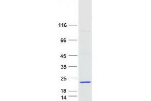 Validation with Western Blot