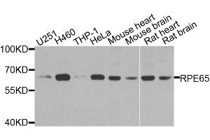 Western blot analysis of extracts of various cell lines, using RPE65 antibody. (RPE65 anticorps)