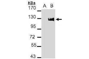 WB Image Western Blot analysis of AXL expression in transfected 293T cell line by AXL polyclonal antibody.