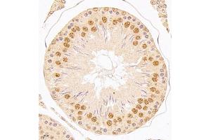 Immunohistochemistry of paraffin embedded rat testis using USP34 (ABIN7076115) at dilution of 1:700 (400x lens) (USP34 anticorps)