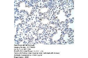 Human Intestine (MCM6 anticorps  (C-Term))