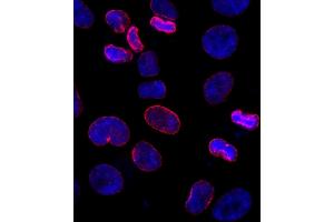 Immunofluorescence (IF) image for anti-Nucleoporin 153kDa (NUP153) (AA 50-100) antibody (ABIN7448391) (NUP153 anticorps  (AA 50-100))