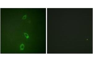 Immunofluorescence (IF) image for anti-Potassium Inwardly-Rectifying Channel, Subfamily J, Member 1 (KCNJ1) (AA 11-60) antibody (ABIN2888901) (KCNJ1 anticorps  (AA 11-60))
