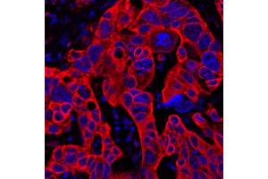Immunofluorescence (IF) image for anti-V-Set Domain Containing T Cell Activation Inhibitor 1 (VTCN1) (AA 30-282) antibody (ABIN7454028)