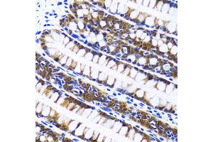 Immunohistochemistry of paraffin-embedded human colon using FASN antibody (ABIN1872662) at dilution of 1:100 (40x lens). (Fatty Acid Synthase anticorps)