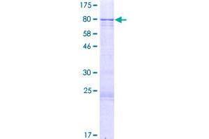 Image no. 1 for Zinc Finger Protein 257 (ZNF257) (AA 1-531) protein (GST tag) (ABIN1326032)