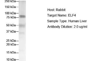 WB Suggested Anti-ELF4 Antibody Titration:  2 ug/ml  ELISA Titer:  1:312500  Positive Control:  Human Liver