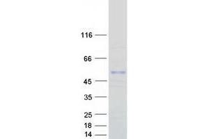 Validation with Western Blot