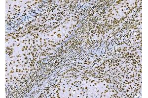 IHC analysis of CTBP2 using anti-CTBP2 antibody (ABIN7601326). (CTBP2 anticorps  (AA 321-445))