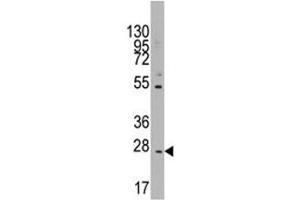 Western blot analysis of CD8B in K562 lysate (CD8B anticorps  (AA 64-92))