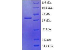 SDS-PAGE (SDS) image for Ribosomal Protein L30 (RPL30) (AA 1-115), (full length) protein (GST tag) (ABIN5710276) (RPL30 Protein (AA 1-115, full length) (GST tag))