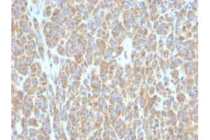 Image no. 1 for anti-B-Cell CLL/lymphoma 6 (BCL6) antibody (ABIN6175703) (BCL6 anticorps)