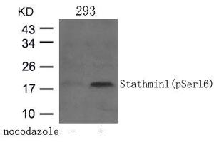 Western blot analysis of extracts from 293 cells untreated or treated with Nocodazol using Stathmin 1(Phospho-Ser16) Antibody. (Stathmin 1 anticorps  (pSer16))