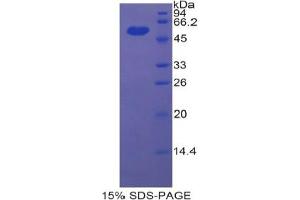 SDS-PAGE analysis of Rat ENPP1 Protein. (ENPP1 Protéine)