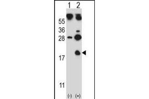 Western blot analysis of HBG1 (arrow) using rabbit polyclonal HBG1 Antibody (Center) (ABIN657619 and ABIN2846615).