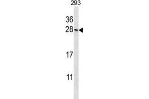 Western Blotting (WB) image for anti-Homeobox B4 (HOXB4) antibody (ABIN2998005) (HOXB4 anticorps)
