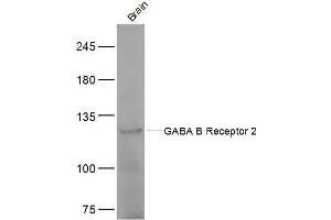Mouse brain lysates probed with GABA B Receptor 2 Polyclonal Antibody, Unconjugated  at 1:500 dilution and 4˚C overnight incubation. (GABBR2 anticorps  (AA 501-650))