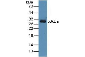 Figure. (TOLLIP anticorps  (AA 19-254))
