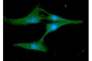 ICC/IF analysis of Synaptobrevin2 in U87MG cells line, stained with DAPI (Blue) for nucleus staining and monoclonal anti-human Synaptobrevin2 antibody (1:100) with goat anti-mouse IgG-Alexa fluor 488 conjugate (Green).