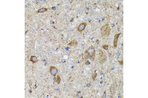 Immunohistochemistry of paraffin-embedded mouse spinal cord using HYOU1 antibody.