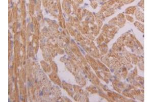 DAB staining on IHC-P; Samples: Mouse Heart Tissue (Hexokinase 1 anticorps  (AA 676-800))