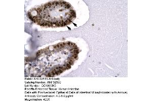 Human Intestine (SIRT5 anticorps  (C-Term))