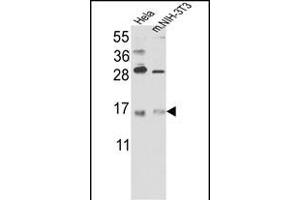 Western blot analysis of RBM3 Antibody (C-term) (Cat. (RBM3 anticorps  (C-Term))