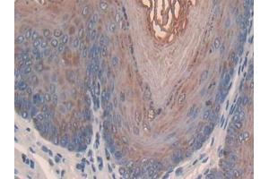 DAB staining on IHC-P; Samples: Mouse Esophagus Tissue (SLPI anticorps  (AA 20-131))