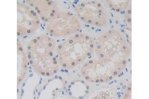 Used in DAB staining on fromalin fixed paraffin- embedded kidney tissue (Fibrillarin anticorps  (AA 37-275))