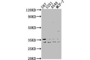 Western Blot Positive WB detected in: U87 whole cell lysate, U251 whole cell lysate, A549 whole cell lysate, MCF-7 whole cell lysate All lanes: ATP6V1D antibody at 1:2000 Secondary Goat polyclonal to rabbit IgG at 1/50000 dilution Predicted band size: 29 kDa Observed band size: 29 kDa (ATP6V1D anticorps  (AA 1-247))