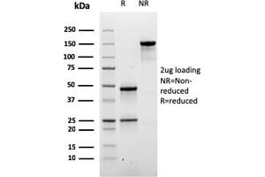 SDS-PAGE Analysis of Purified Desmoglein-3 Mouse Monoclonal Antibody (DSG3/2840). (Desmoglein 3 anticorps  (AA 379-491))