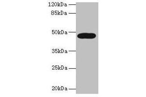 Western blot All lanes: LIPA antibody at 10 μg/mL + A431 whole cell lysate Secondary Goat polyclonal to rabbit IgG at 1/10000 dilution Predicted band size: 46, 40 kDa Observed band size: 46 kDa (Lipase A anticorps  (AA 22-399))
