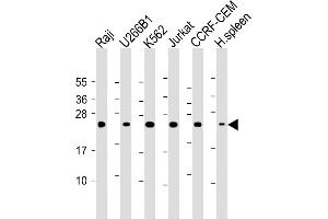 All lanes : Anti- CTLA4 Antibody (N-term) at 1:2000 dilution Lane 1: Raji whole cell lysate Lane 2: U266B1 whole cell lysate Lane 3: K562 whole cell lysate Lane 4: Jurkat whole cell lysate Lane 5: CCRF-CEM whole cell lysate Lane 6: Human spleen lysate Lysates/proteins at 20 μg per lane. (CTLA4 anticorps  (AA 50-78))
