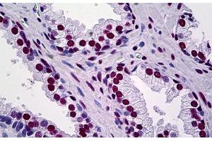 Human Prostate: Formalin-Fixed, Paraffin-Embedded (FFPE) (KAP1 anticorps  (AA 379-524))