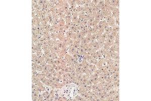 Immunohistochemical analysis of paraffin-embedded human liver tissue using (ABIN657731 and ABIN2846716) performed on the Leica® BOND RXm. (RAB1B anticorps  (C-Term))