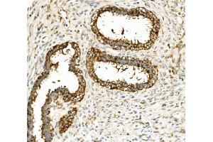 IHC analysis of Hexokinase 1/HK1 using anti-Hexokinase 1/HK1 antibody (ABIN7600258). (Hexokinase 1 anticorps  (AA 17-323))